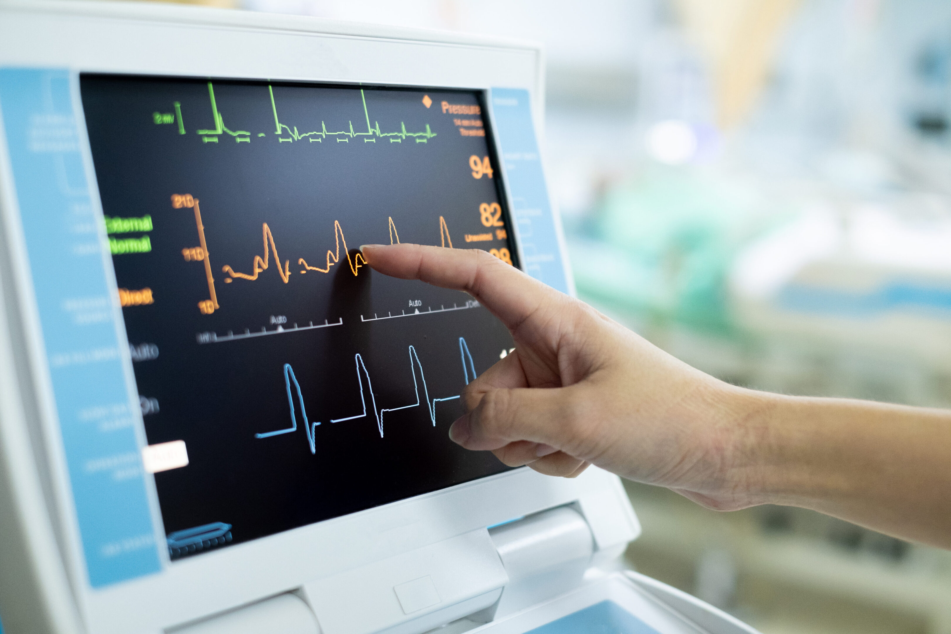 EKG monitor in intra aortic balloon pump machine. Medical equipment EKG monitor in intra aortic balloon pump machine. Medical equipment